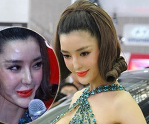 Hàng vạn người tàn phế vì giải phẫu thẩm mỹ