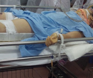 Nữ sinh lớp 8 rơi từ tầng 3 xuống đất tiên lượng khó qua khỏi