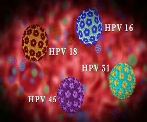 Sốc: Căn bệnh giết chết 9 phụ nữ Việt mỗi ngày