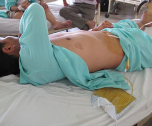 Cuộc sống vợ chồng sau các vụ cắt "của quý": Một phút sai lầm, một đời day dứt