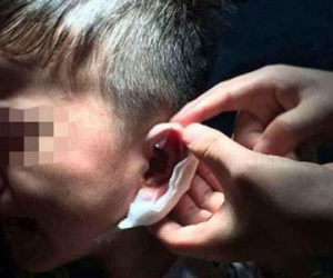 Cô giáo mầm non dùng dập ghim dập tai học sinh giờ nghỉ trưa