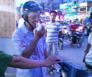 Tài xế taxi đấm gãy mũi người đi xe máy