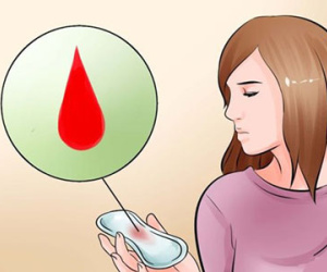 Những điều cần biết khi âm đạo chảy máu bất thường