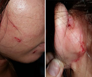Phản ảnh cân thiếu hải sản, nữ du khách bị đánh rách mặt