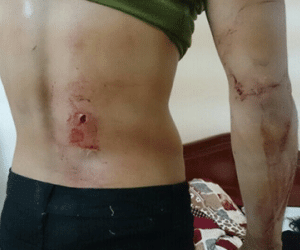 Thêm thông tin vụ cascadeur bị đâm chém tại Cần Thơ