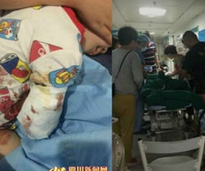 Thăm vườn bách thảo, bé 2 tuổi bị hổ cắn đứt cánh tay