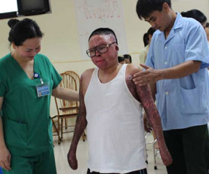 Nghị lực phi thường của người lính sống sót sau vụ máy bay rơi