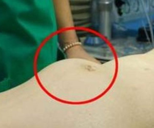 Căn bệnh nguy hiểm có tên "cái chết không hẹn trước" bạn cần biết
