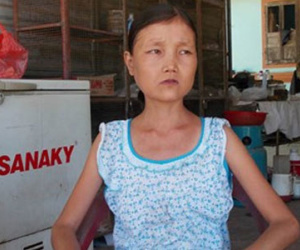 Kỳ lạ cô gái mỗi bữa ăn 6 lon gạo, uống 15 lít nước một ngày