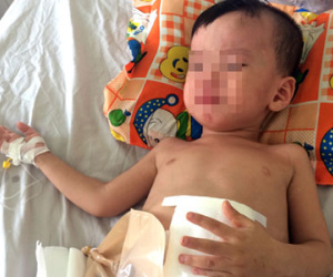 Bé 3 tuổi phải cấp cứu sau cú đạp của cha dượng