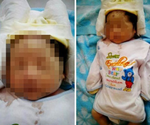 Sản phụ có con "ruột trào khỏi bụng" tố bệnh viện khiến trẻ chết oan