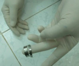 Bi hài quý ông cấy dị vật vào “của quý” để “hóa rồng” chốn phòng the