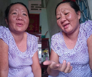 Dùng thuốc dị ứng, bà bầu "biến thành" bà lão U60