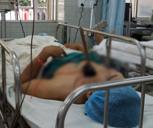 Bị truy bắt, trộm chó bắn tên vào ngực một dân phòng