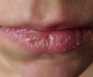 Nguy cơ hỏng môi, ngộ độc chì từ son môi kém chất lượng
