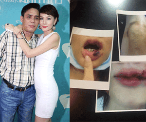 Dương Yến Ngọc tung ảnh bầm dập vì bị chồng cũ bạo hành dã man