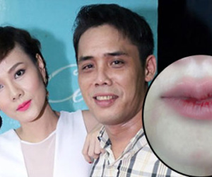 Chồng Dương Yến Ngọc phủ nhận đánh vợ