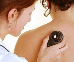 Cách phân biệt mụn nhọt thông thường và ung thư da