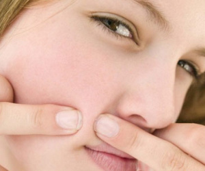 Không nên nặn mụn ở những vùng “tử thần” nào?