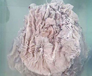 Linh chi 25 kg giá ước tính gần 1 tỷ USD