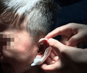 Những vụ bảo mẫu bạo hành trẻ em chấn động dư luận thế giới