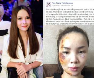 Yến Trang: "Đập mặt xuống đường mà vẫn mắt bồ câu thì đúng là siêu phàm"