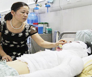 Hà Nội: Nam sinh trường Đại học Sân khấu Điện ảnh bị tạt axit lúc nửa đêm