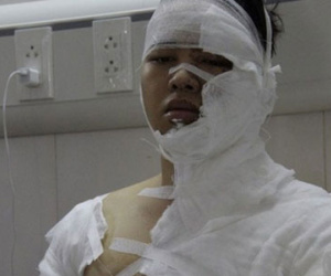 Nam sinh ĐH Sân khấu Điện ảnh bị "khủng bố" trước khi bị tạt axit