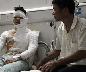 Vụ tạt axit ở Hà Nội: "Mày mà xuống nhập học tao không làm người"