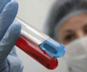 Phát hiện "siêu kháng thể" tiêu diệt virus HIV