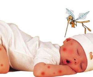 Biến chứng nguy hiểm khi coi thường sốt xuất huyết