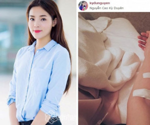 Hoa hậu Kỳ Duyên phải truyền nước vì mệt mỏi sau scandal thẩm mỹ?