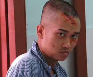 Con nghiện đâm dã man nhân viên nhà nghỉ lúc nửa đêm