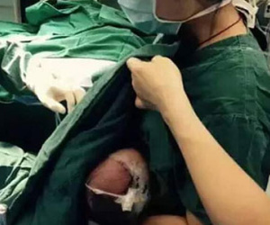 Nữ y tá vừa phẫu thuật vừa cho bú ngay trên bàn mổ