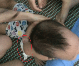 Cháu bé bị 3 giáo viên trói, nhét khăn vào miệng phải nhập viện