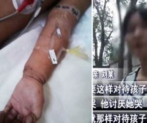 Bé 2 tuổi hôn mê vì bị người tình của mẹ đánh đập tàn bạo
