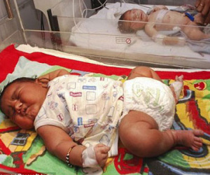 Ấn Độ: Bé sơ sinh nặng gần 6kg