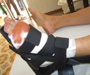 Cắt gân hàng xóm vì nghi trộm chó của gia đình
