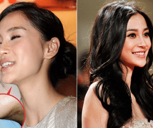 Angelababy sẽ giám định mặt để chứng minh không "dao kéo"