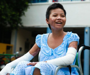 Nụ cười ngày xuất viện của bé gái bán vé số bị mẹ đốt