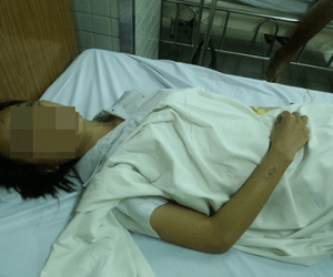 Bắt hung thủ tạt axít 2 nữ sinh ở Sài Gòn