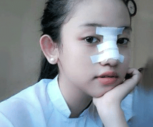Nữ sinh vụ Midu - Phan Thành: Ba mẹ cho tiền sửa mũi 2 lần