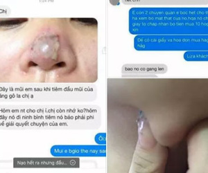 Tràn lan mốt làm đẹp tiêm Filler và hiểm họa khi tiêm phải chất dởm