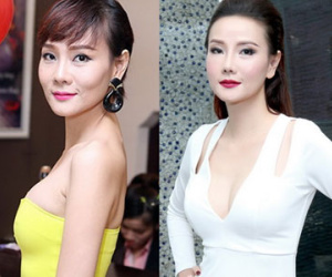 Dương Yến Ngọc không ngại công khai "dao kéo" sau ly hôn