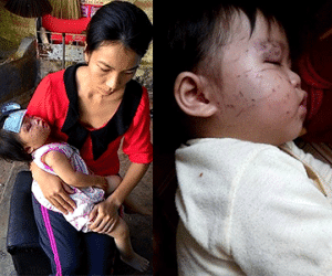Bé 1 tuổi bị cào cấu chi chít: Người mẹ bức xúc trước thái độ thờ ơ của nhà trường
