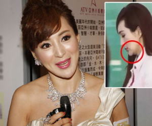 Hoa hậu châu Á sửa cằm nhọn, bị đồn cặp một lúc hai đại gia