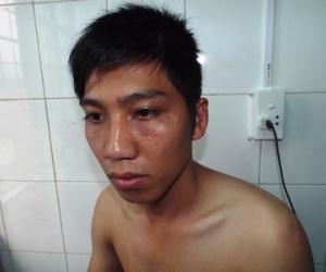Công an huyện tiếp nhận đơn tố công an xã đánh dân gây thương tích tại trụ sở
