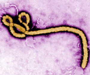 Người tham gia thử văcxin Ebola sẽ được trả 750 bảng Anh