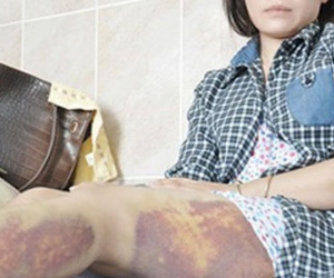 Công an Trảng Bàng xin lỗi nữ công nhân bị đánh nhập viện