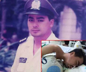 Diễn viên Nguyễn Hoàng phải cắt một phần sọ để giảm nguy cơ thoát vị não